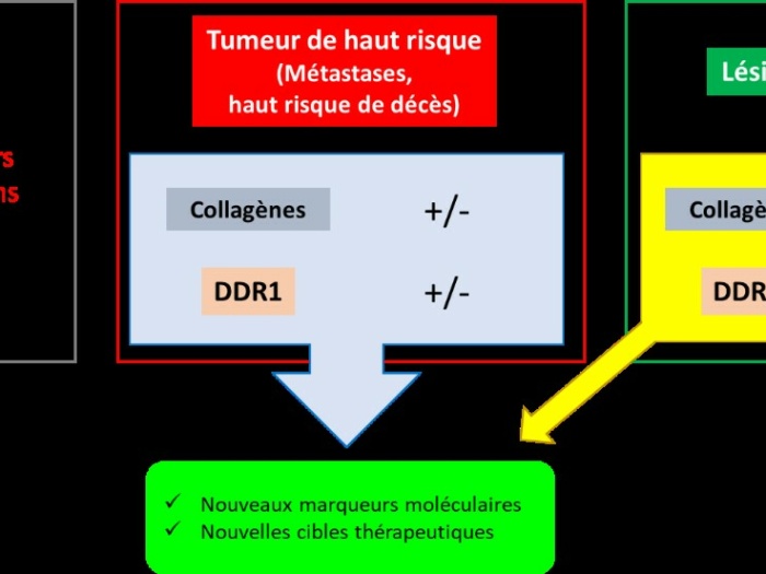 Tumeur_de_Wilms